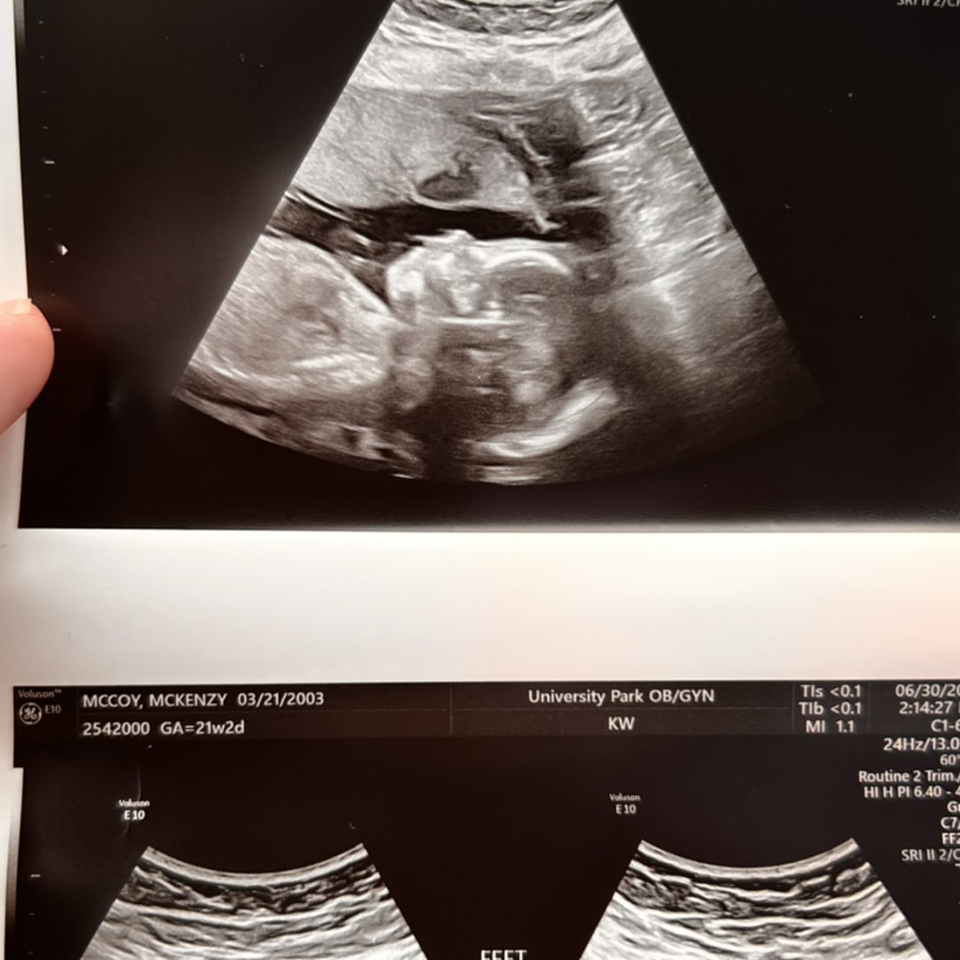 Photo shared by Kenzy for their Babylist baby registry.