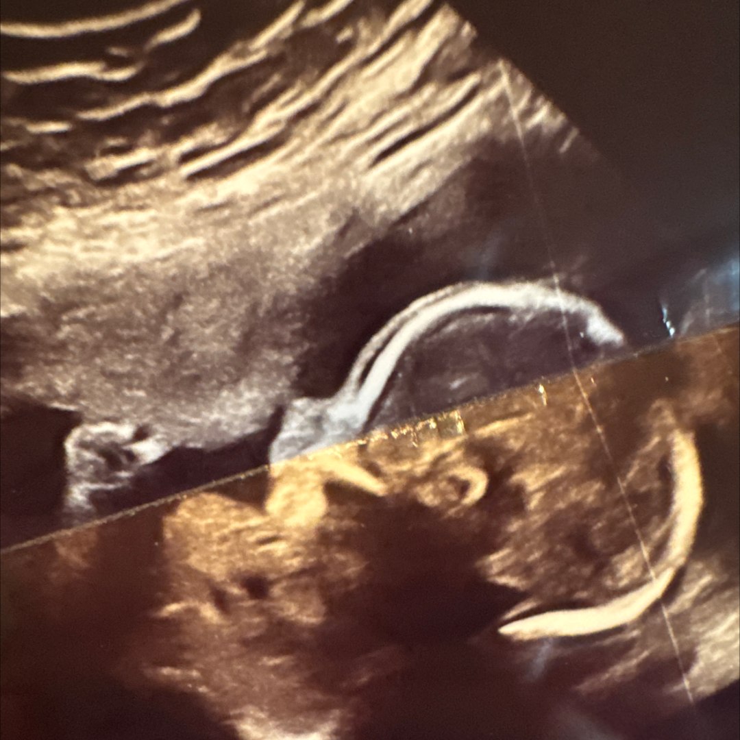 Photo shared by Stephanie for their Babylist baby registry.