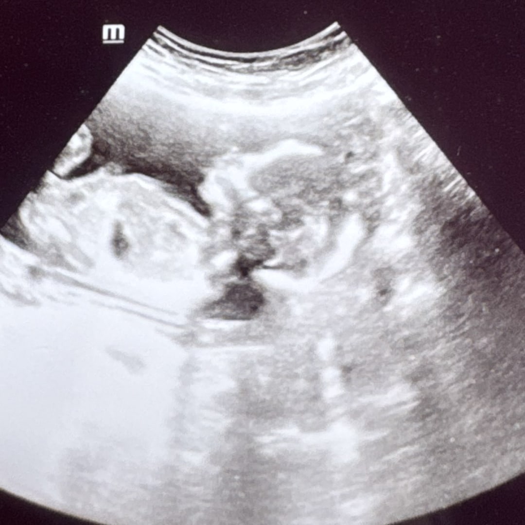 Photo shared by Priscilla for their Babylist baby registry.