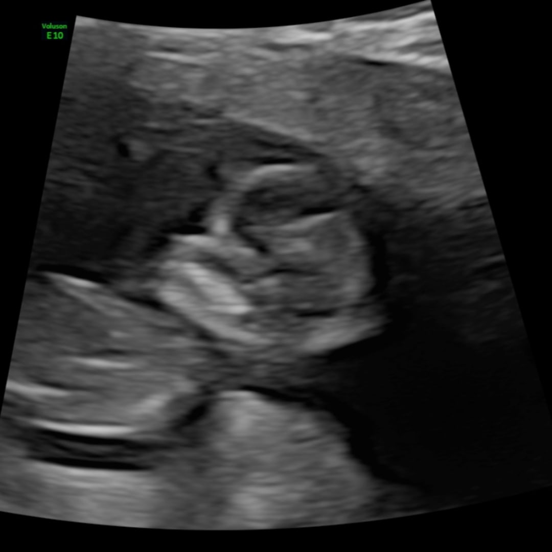 Photo shared by Olga for their Babylist baby registry.