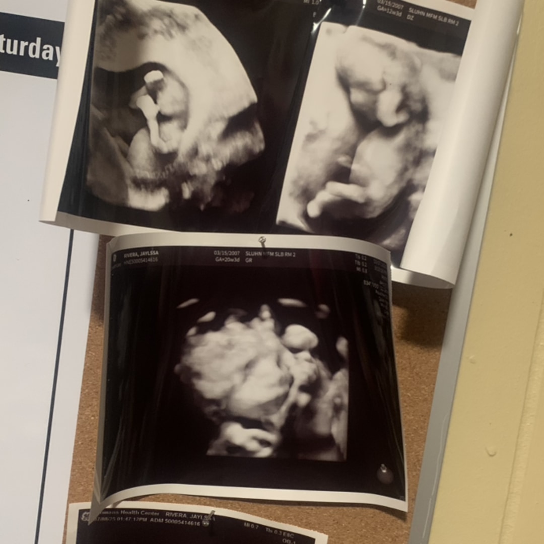 Photo shared by Jaylssa for their Babylist baby registry.