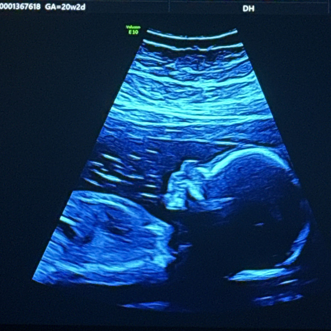 Photo shared by Alex for their Babylist baby registry.