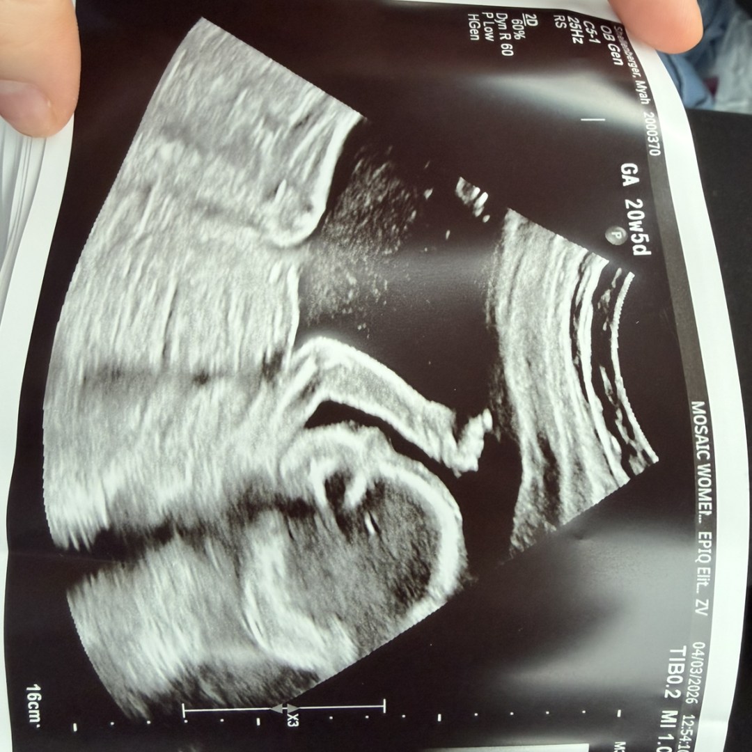 Photo shared by Myah for their Babylist baby registry.