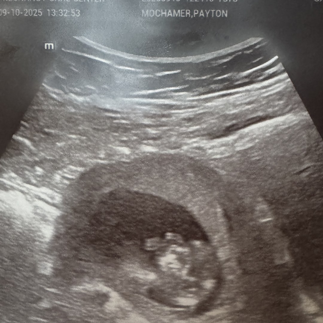 Photo shared by Payton for their Babylist baby registry.