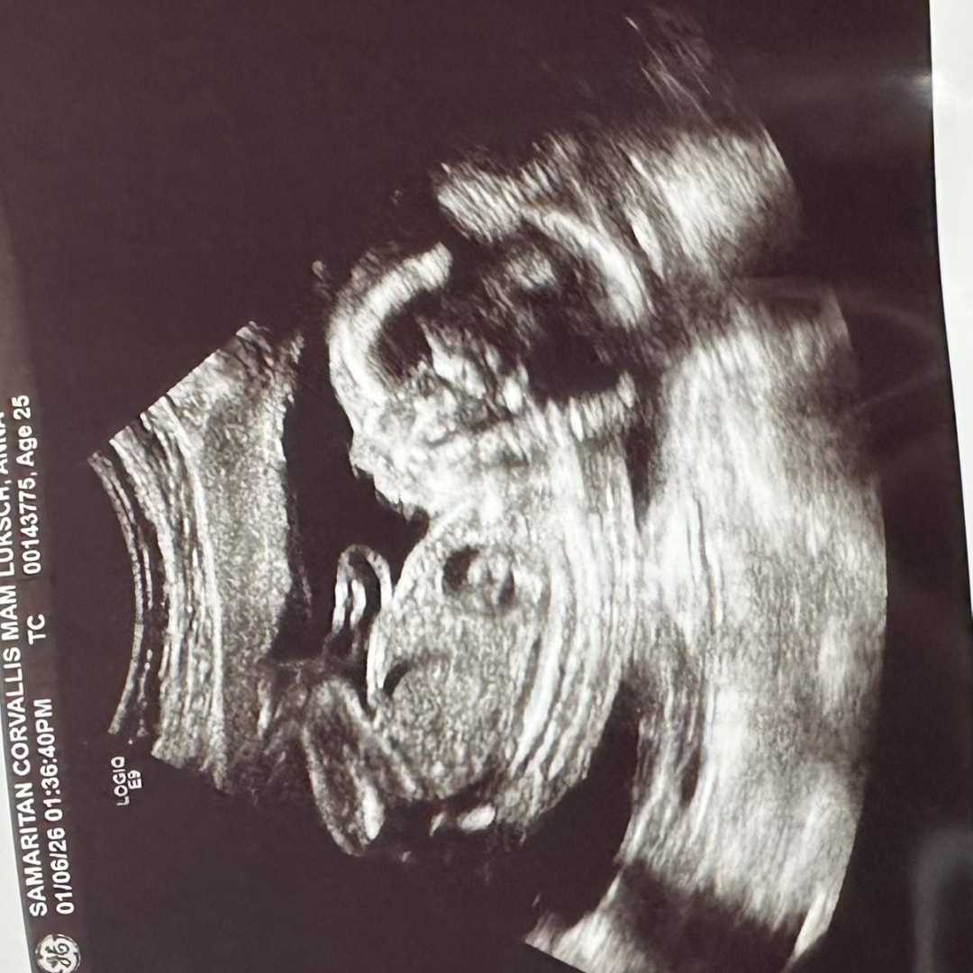 Photo shared by Anna for their Babylist baby registry.