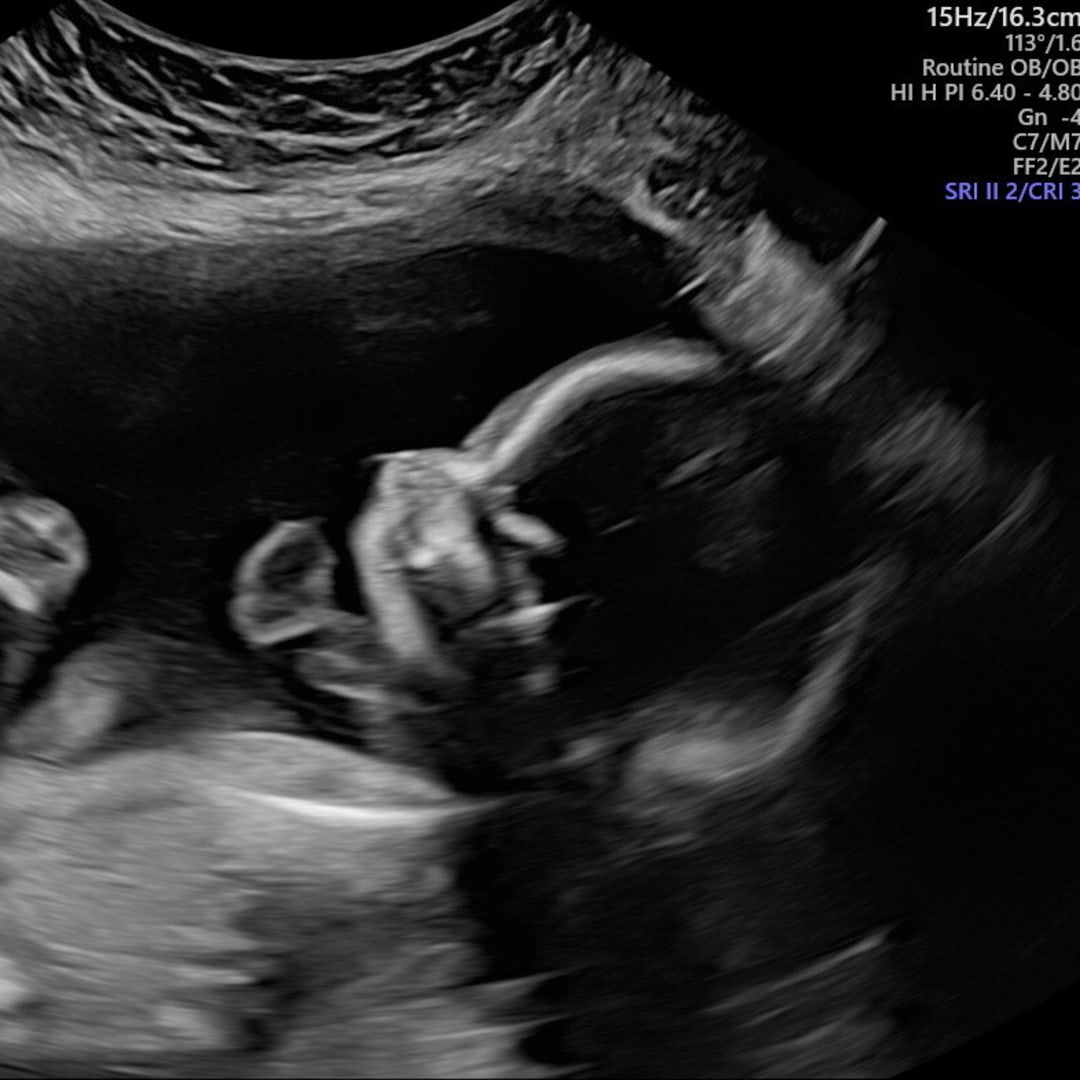 Photo shared by Victoria for their Babylist baby registry.