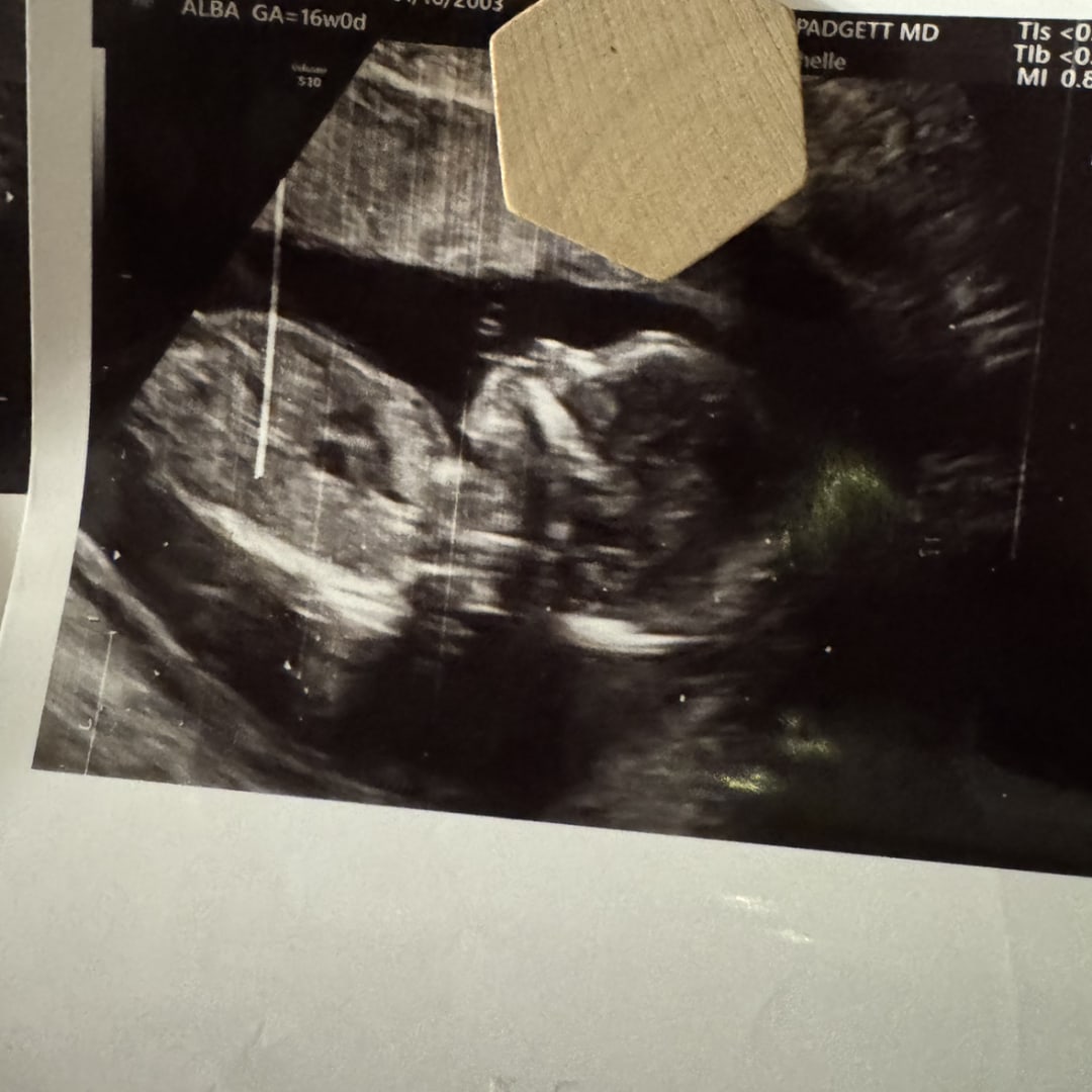 Photo shared by Anna for their Babylist baby registry.