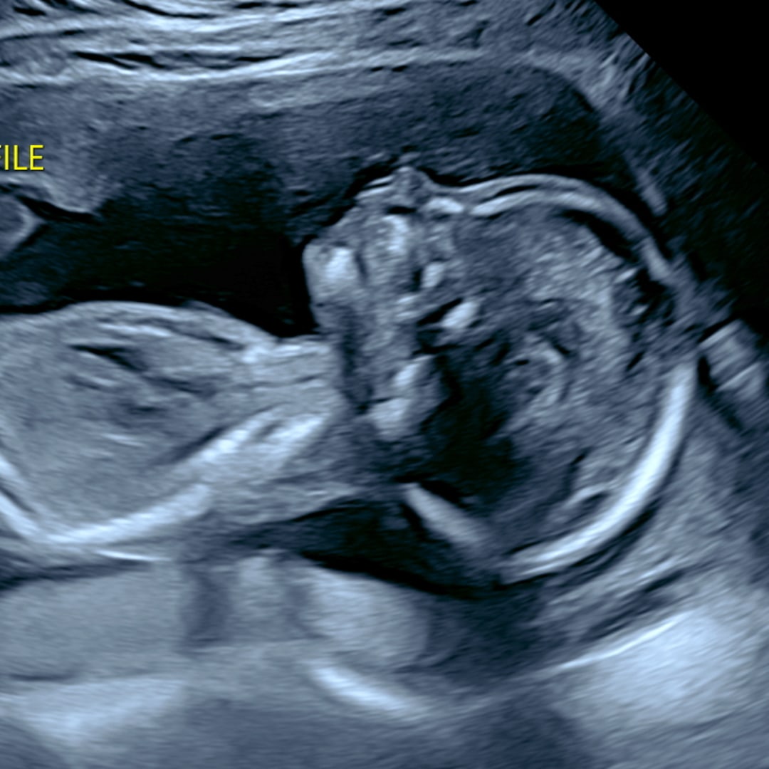 Photo shared by Jordan for their Babylist baby registry.