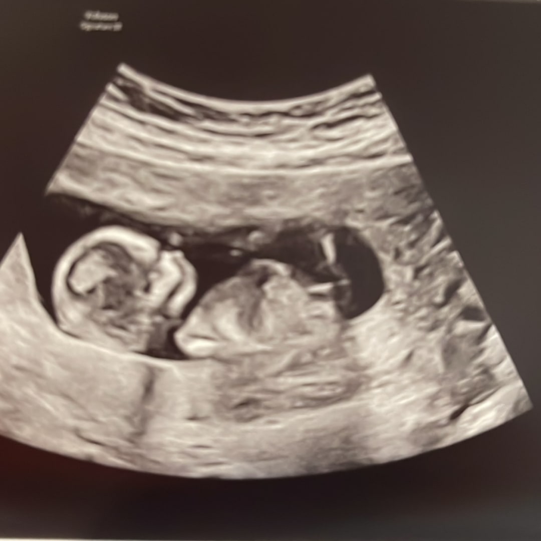 Photo shared by Daleshia for their Babylist baby registry.