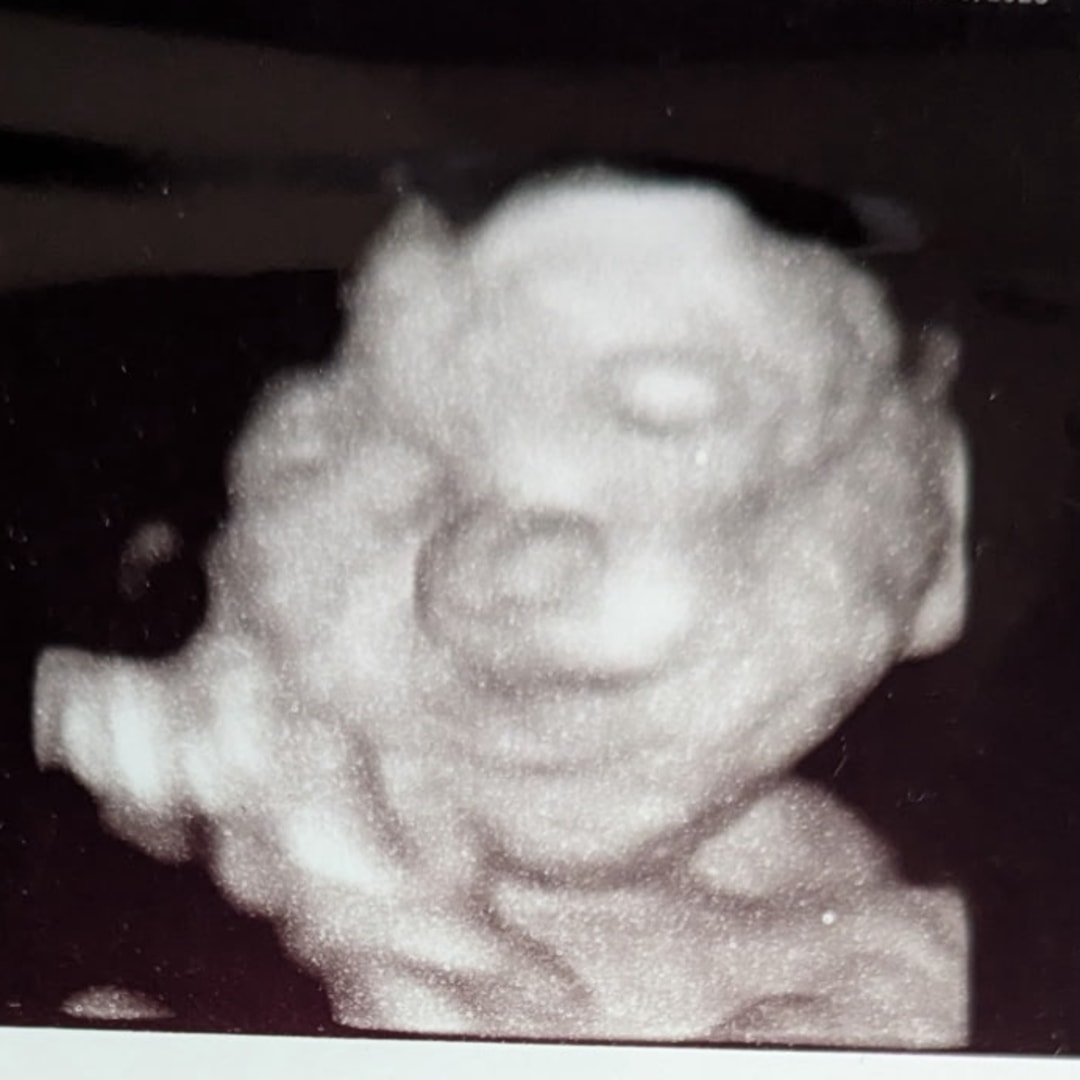 Photo shared by Eva for their Babylist baby registry.