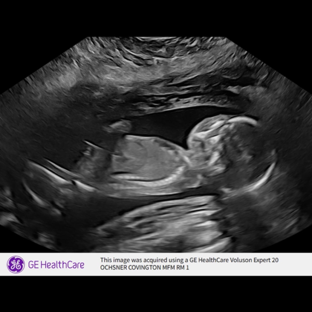 Photo shared by Twee for their Babylist baby registry.