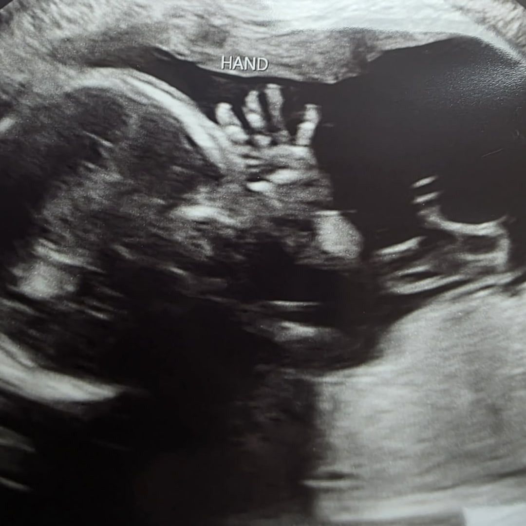 Photo shared by Ashley for their Babylist baby registry.