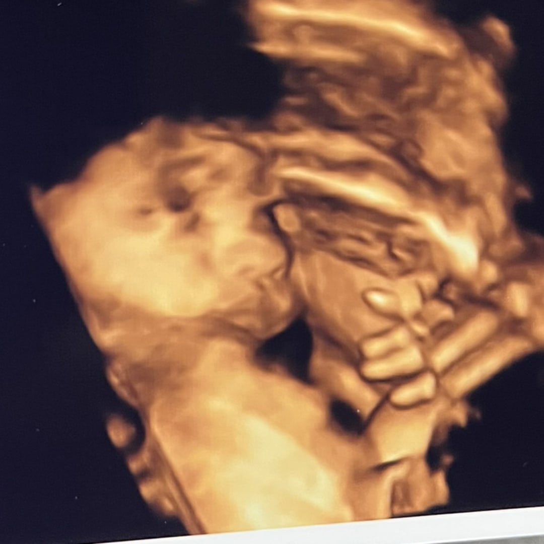 Photo shared by Emmy for their Babylist baby registry.