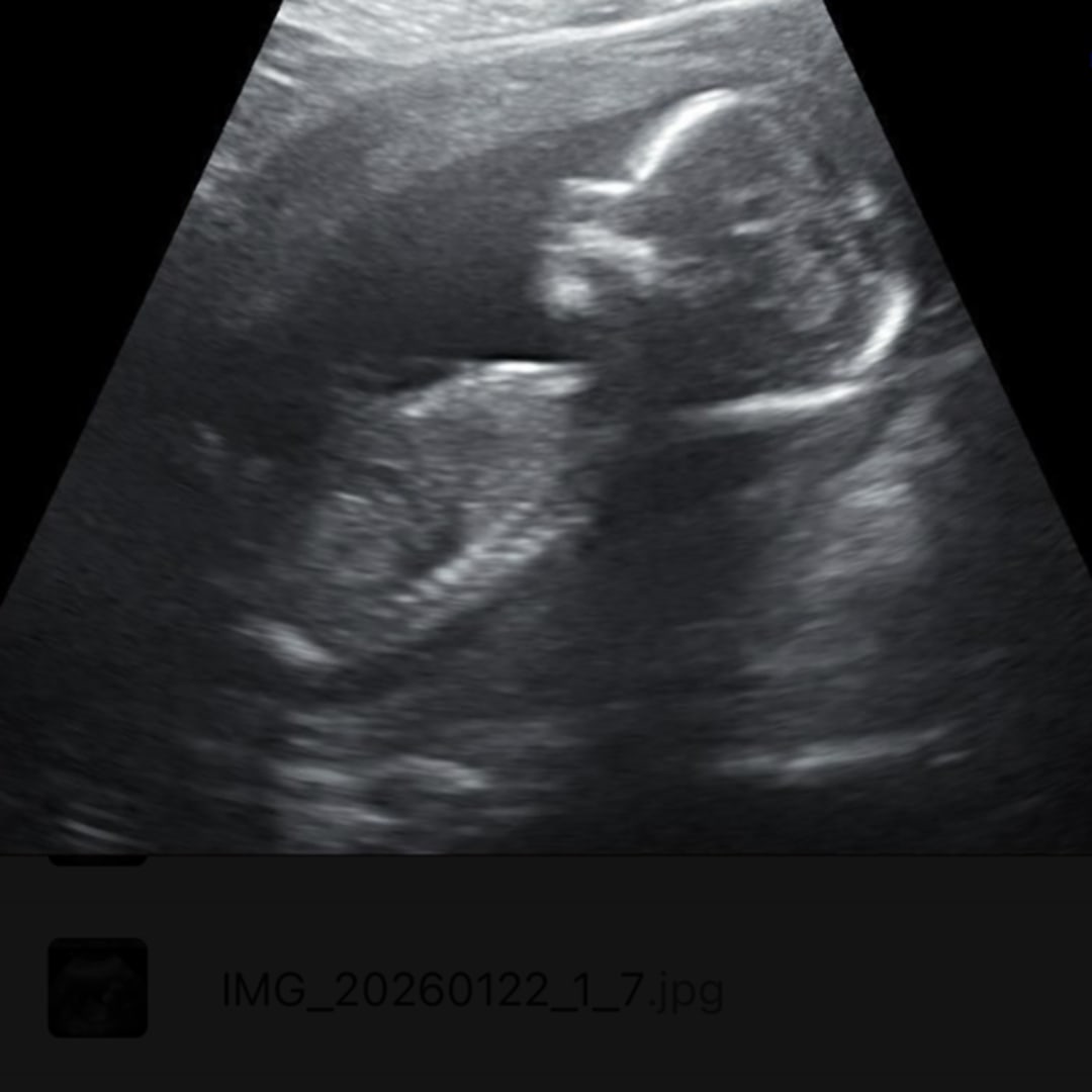 Photo shared by Emeline for their Babylist baby registry.