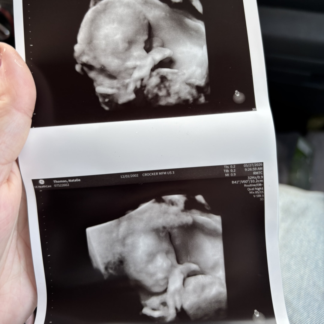 Photo shared by Natalie for their Babylist baby registry.