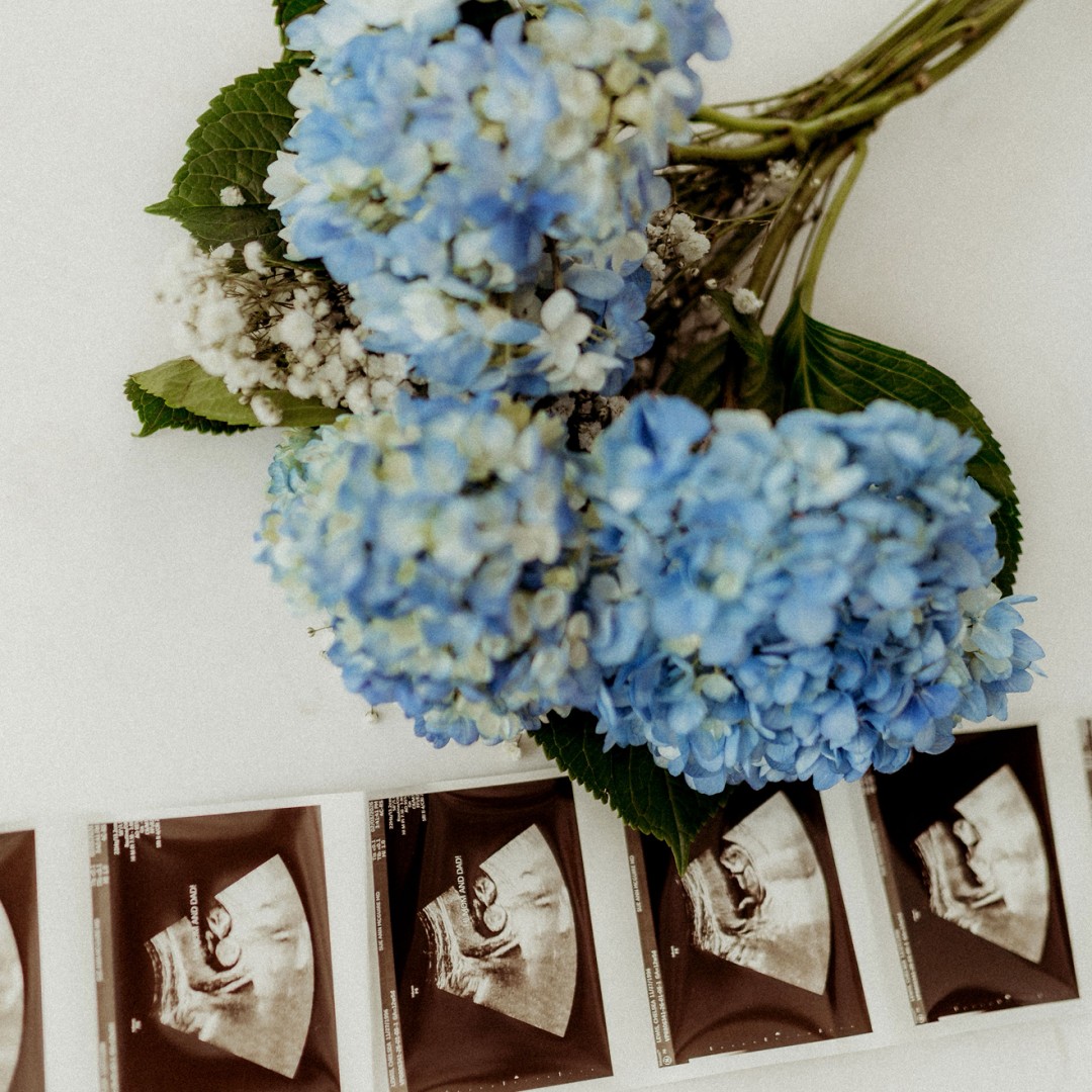 Photo shared by Chelsea for their Babylist baby registry.