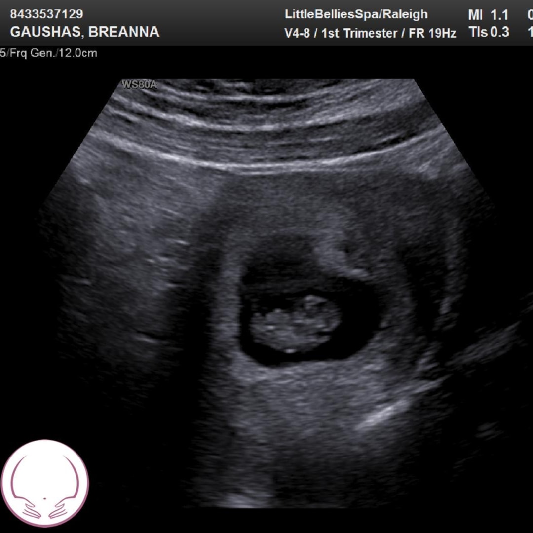 Photo shared by Breanna for their Babylist baby registry.