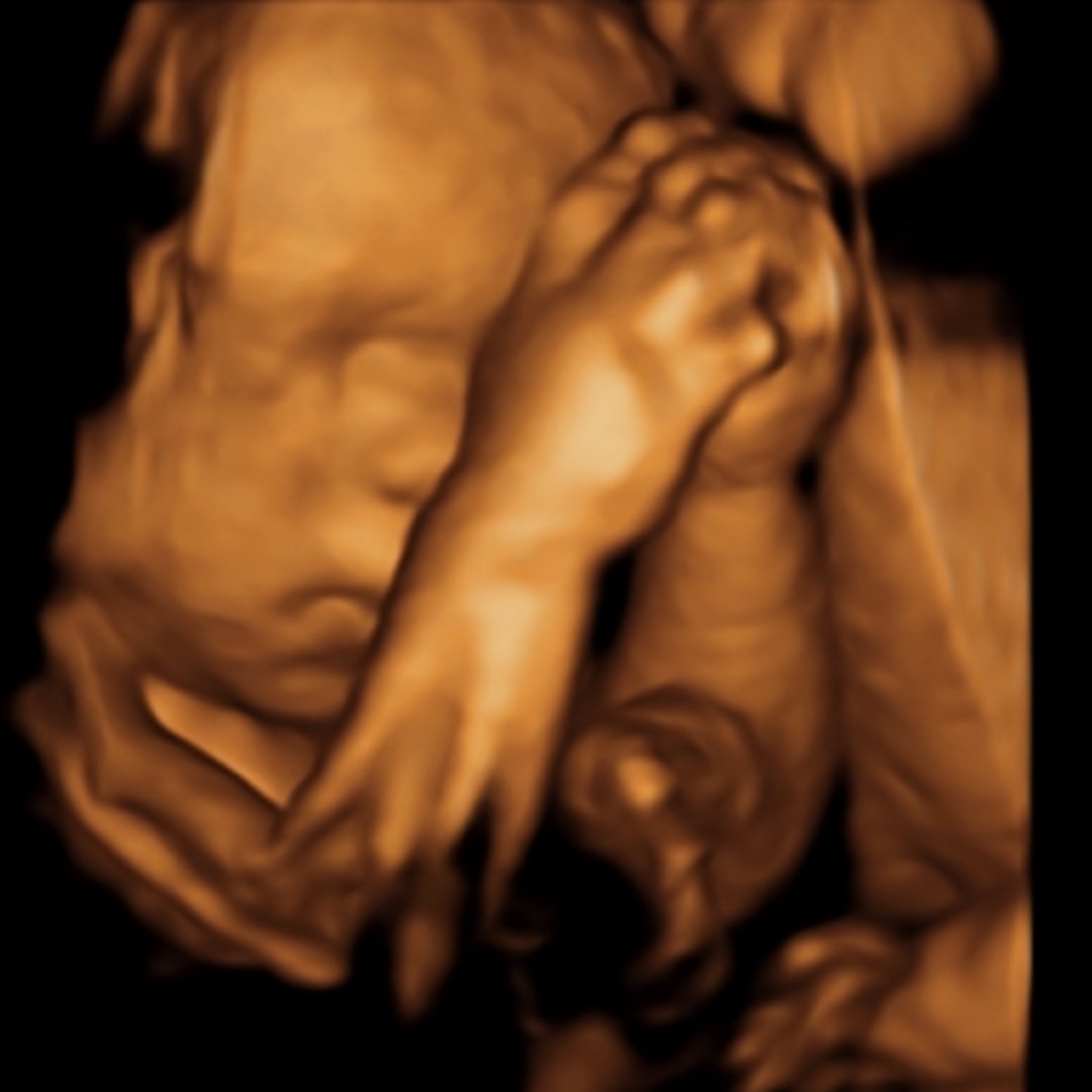 Photo shared by Lauren for their Babylist baby registry.