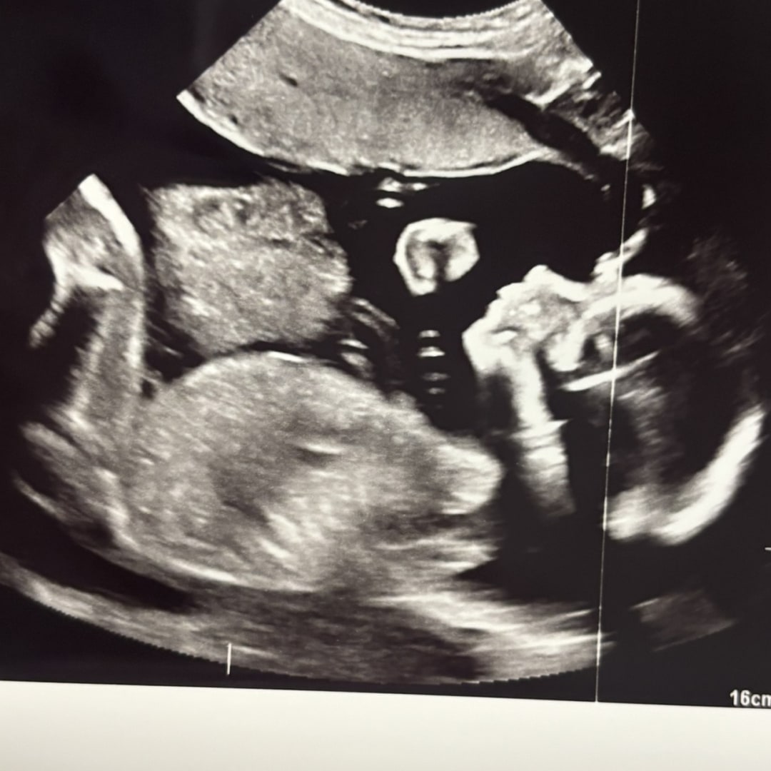 Photo shared by Jordan for their Babylist baby registry.