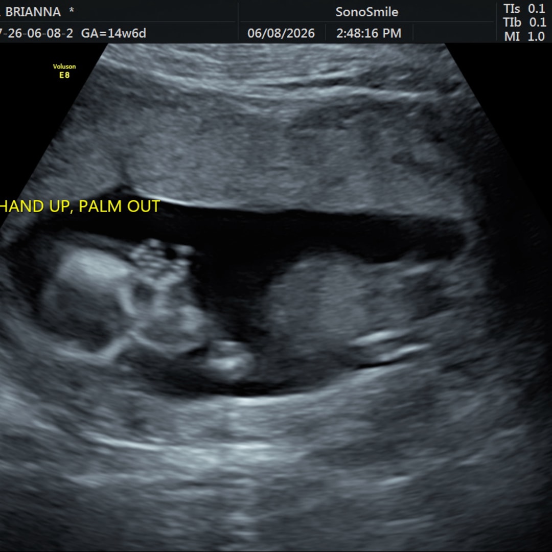Photo shared by Brianna for their Babylist baby registry.