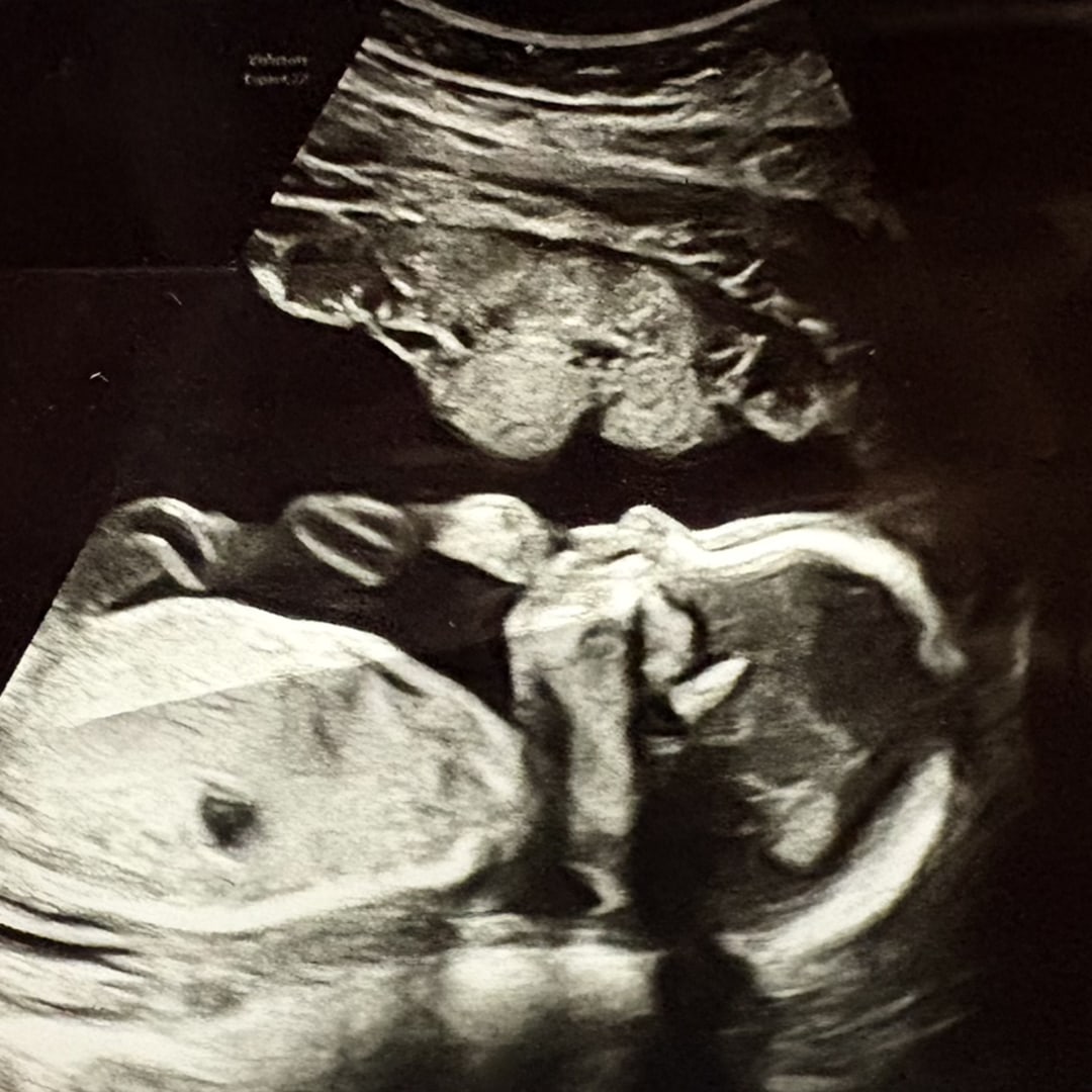 Photo shared by Alina for their Babylist baby registry.
