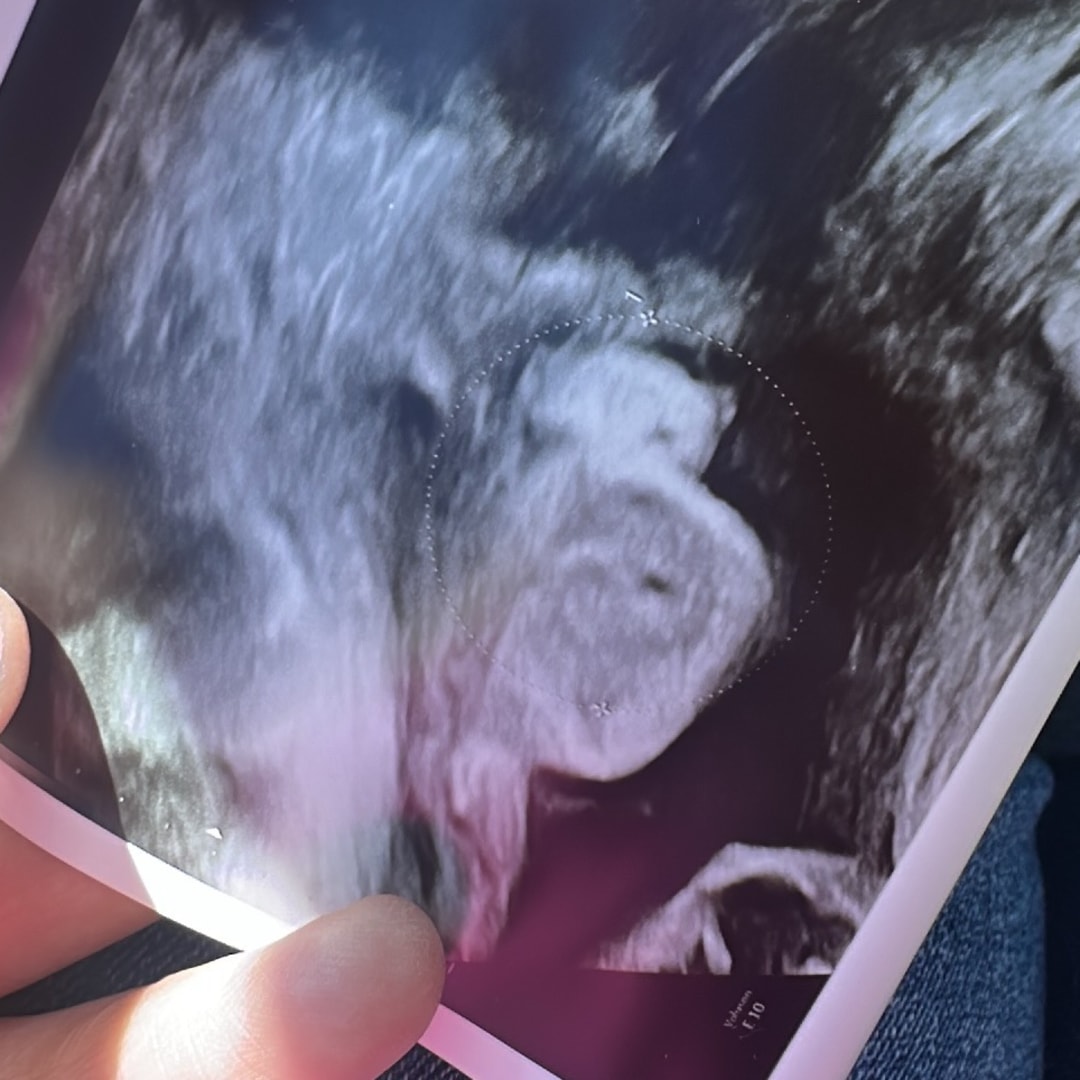 Photo shared by Alina for their Babylist baby registry.