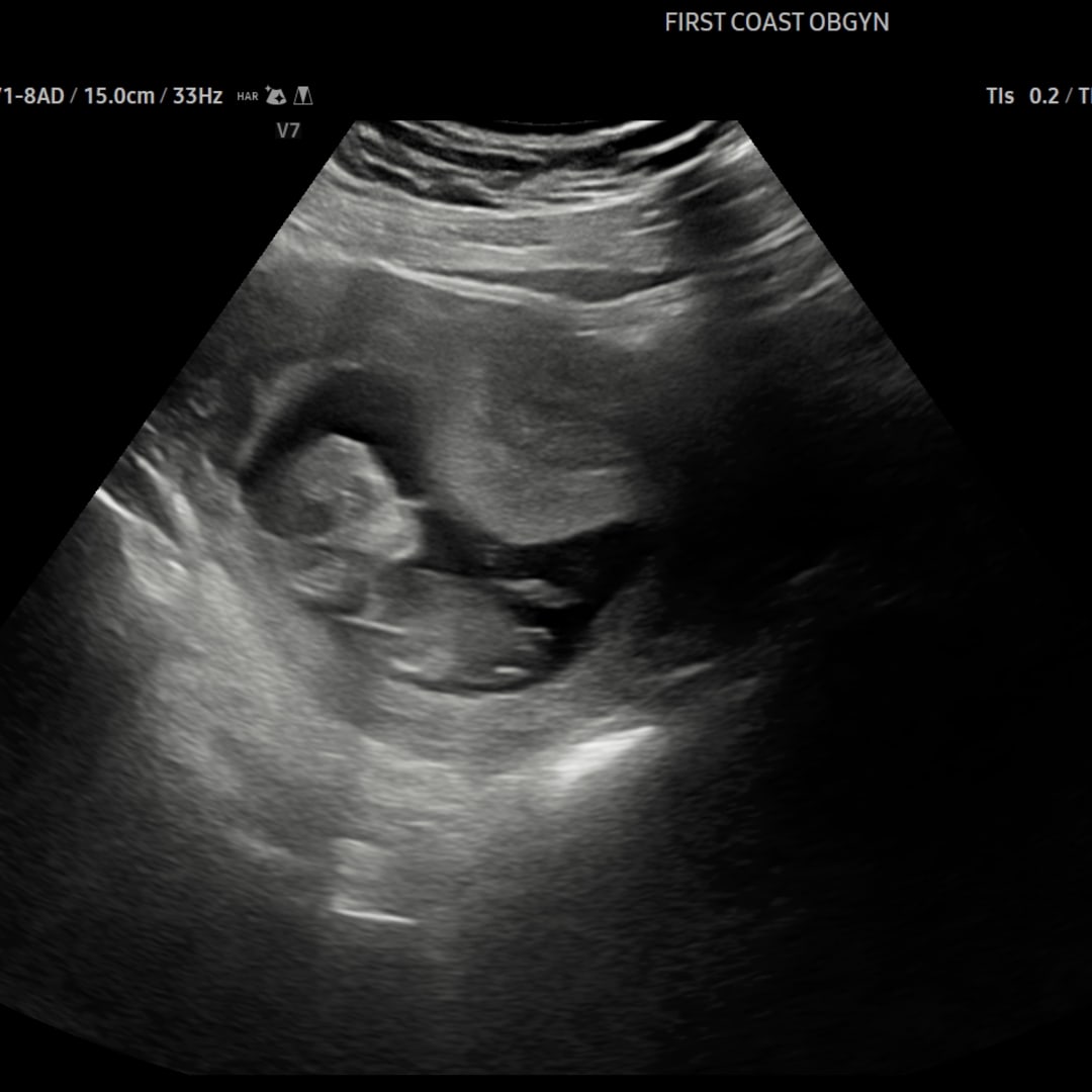 Photo shared by Alison for their Babylist baby registry.