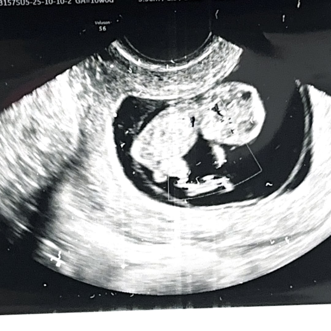 Photo shared by Derya for their Babylist baby registry.