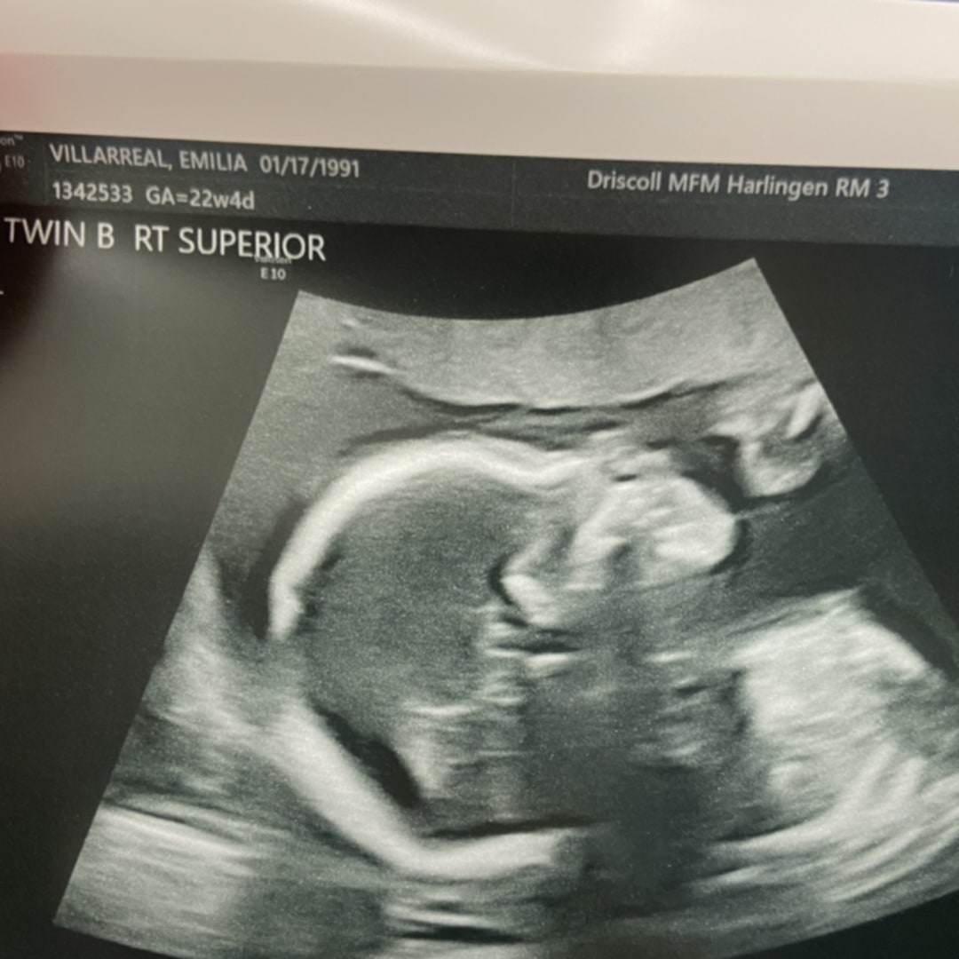 Photo shared by Emily for their Babylist baby registry.