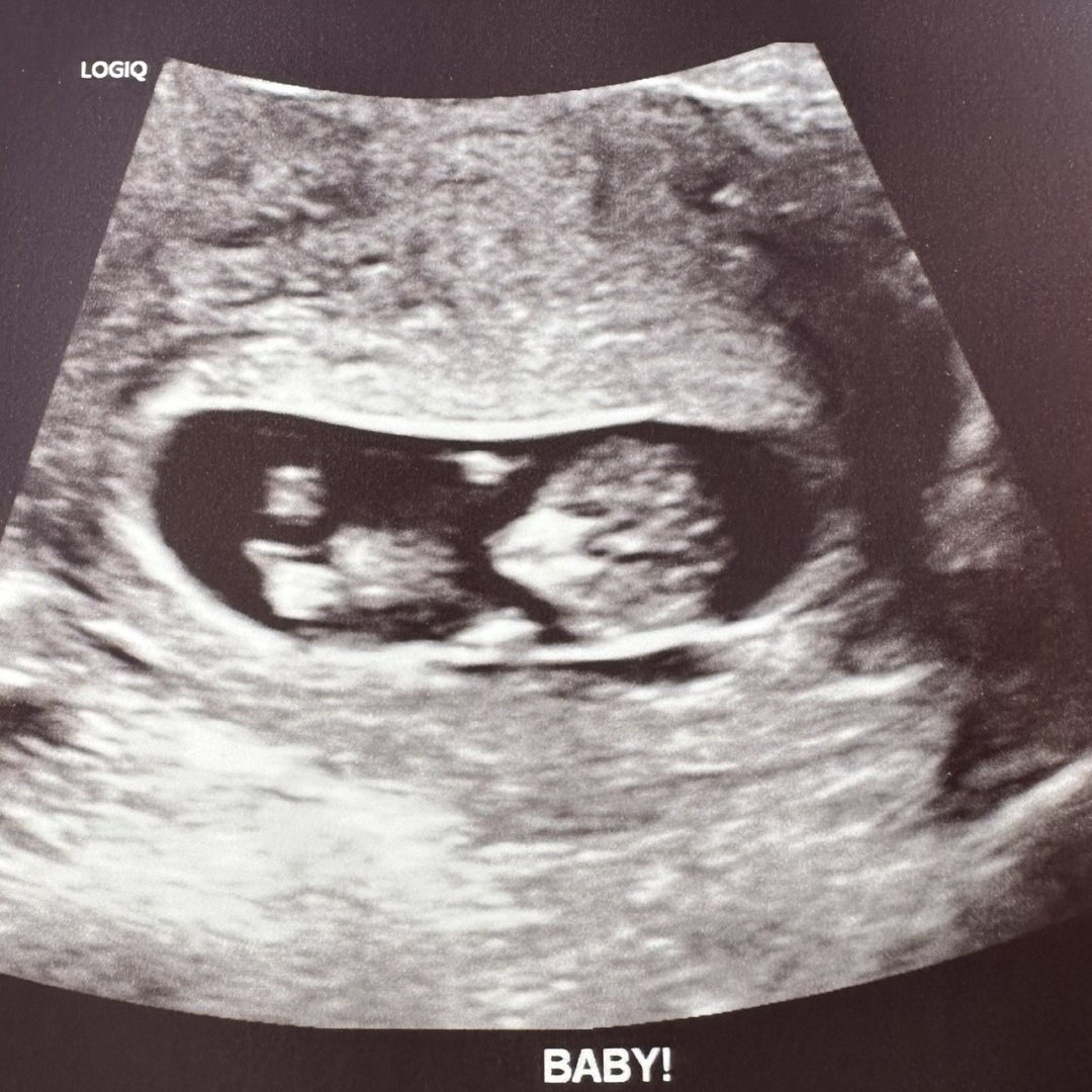 Photo shared by Angeleaque for their Babylist baby registry.