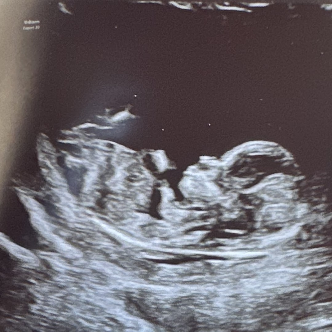 Photo shared by Molly for their Babylist baby registry.