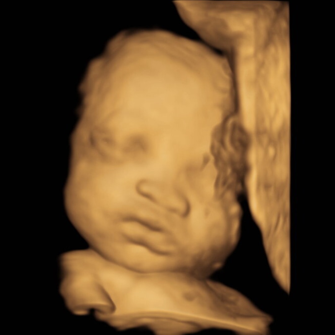 Photo shared by Elise for their Babylist baby registry.