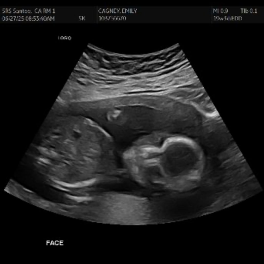 Photo shared by Emily for their Babylist baby registry.