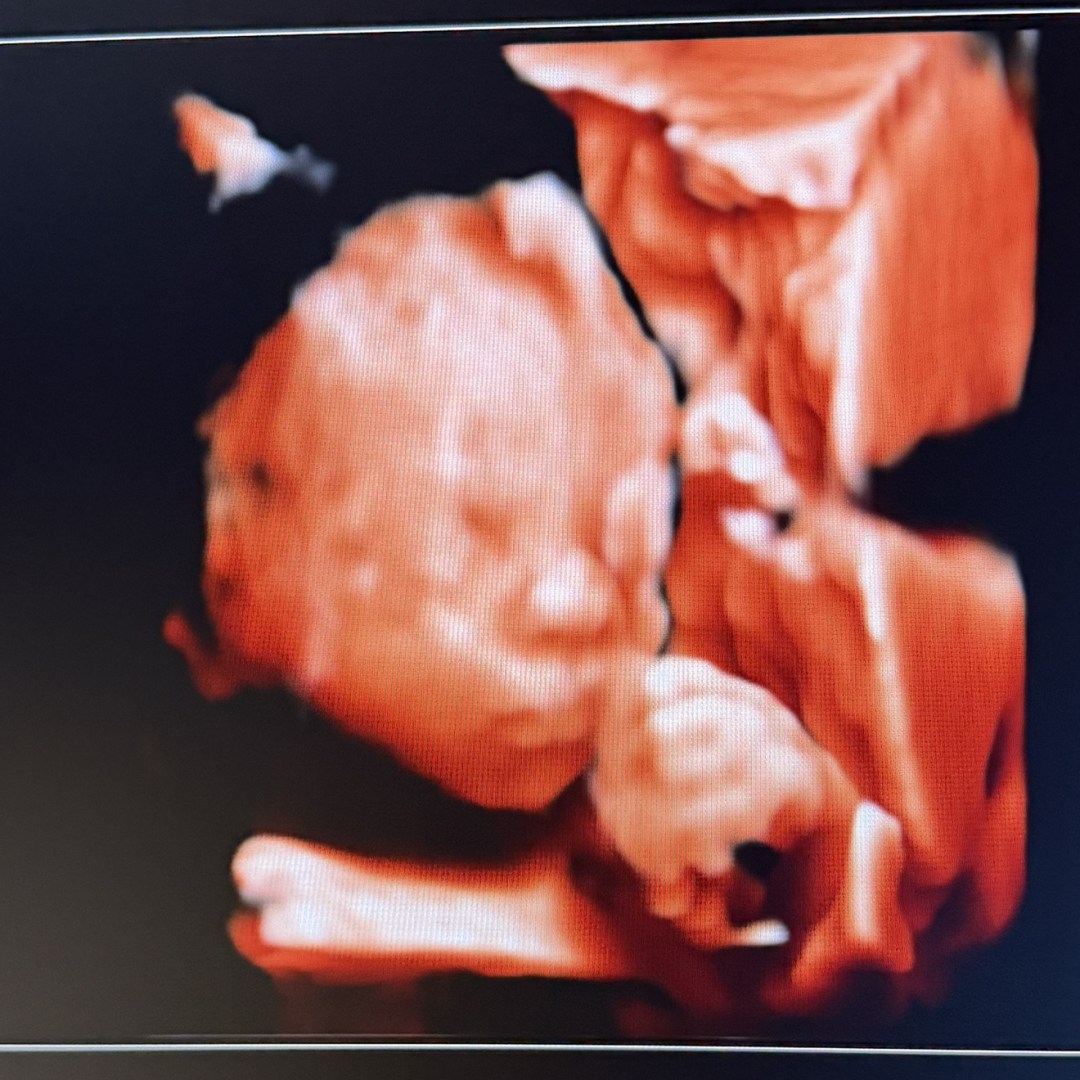 Photo shared by Emily for their Babylist baby registry.
