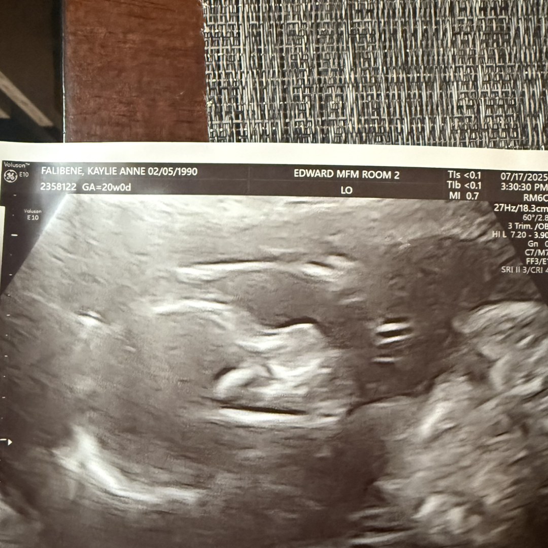 Photo shared by Kaylie for their Babylist baby registry.
