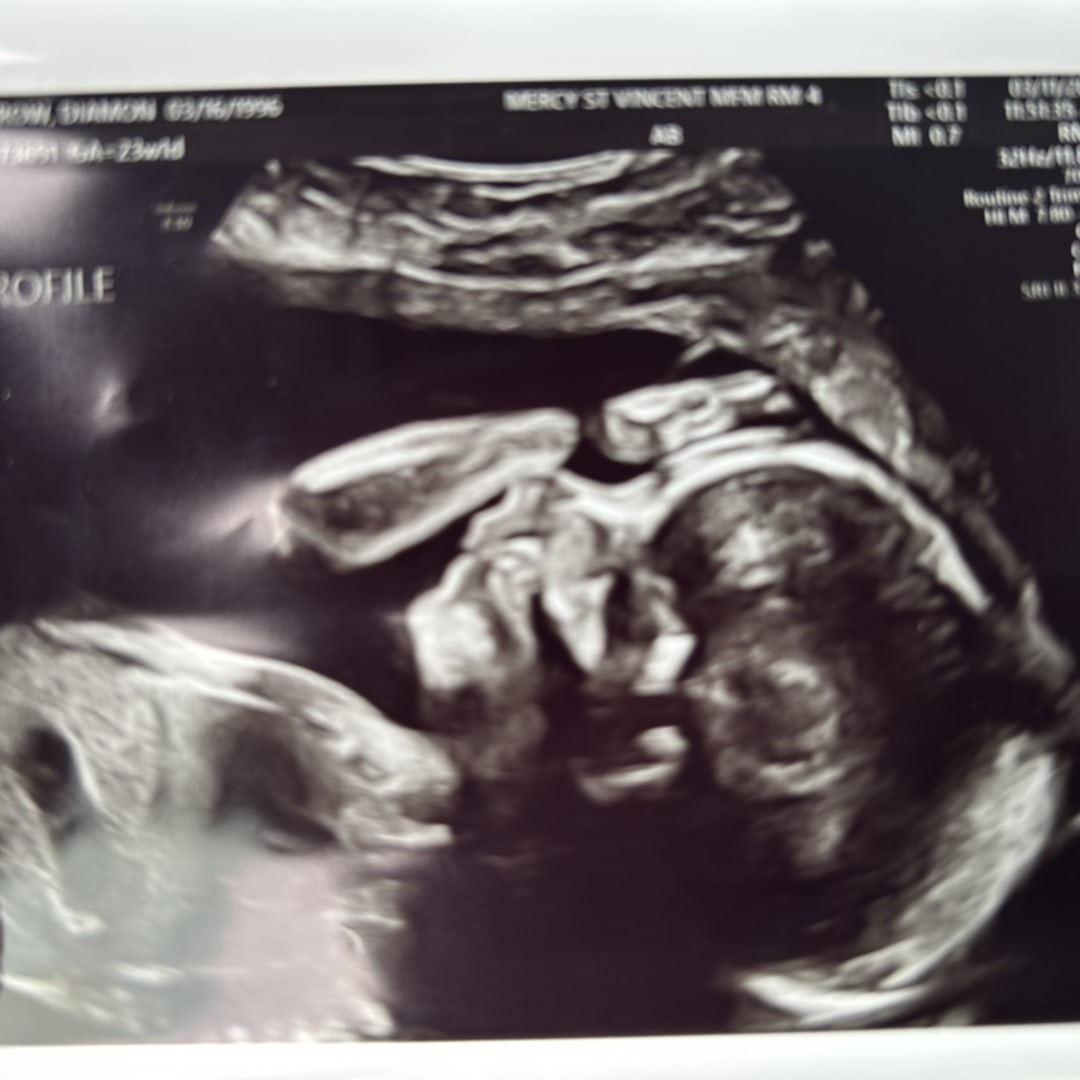 Photo shared by Diamon for their Babylist baby registry.