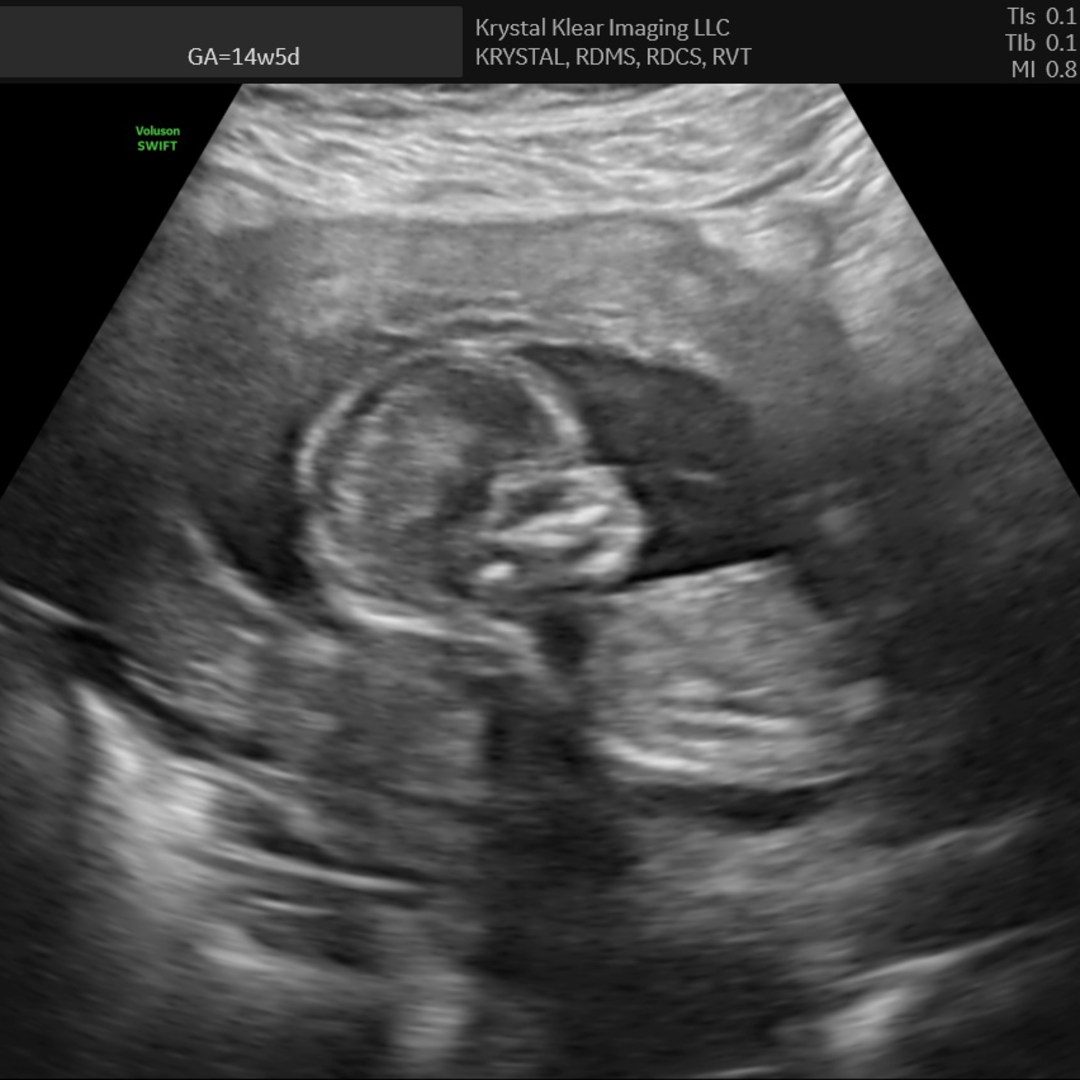 Photo shared by Andrea for their Babylist baby registry.