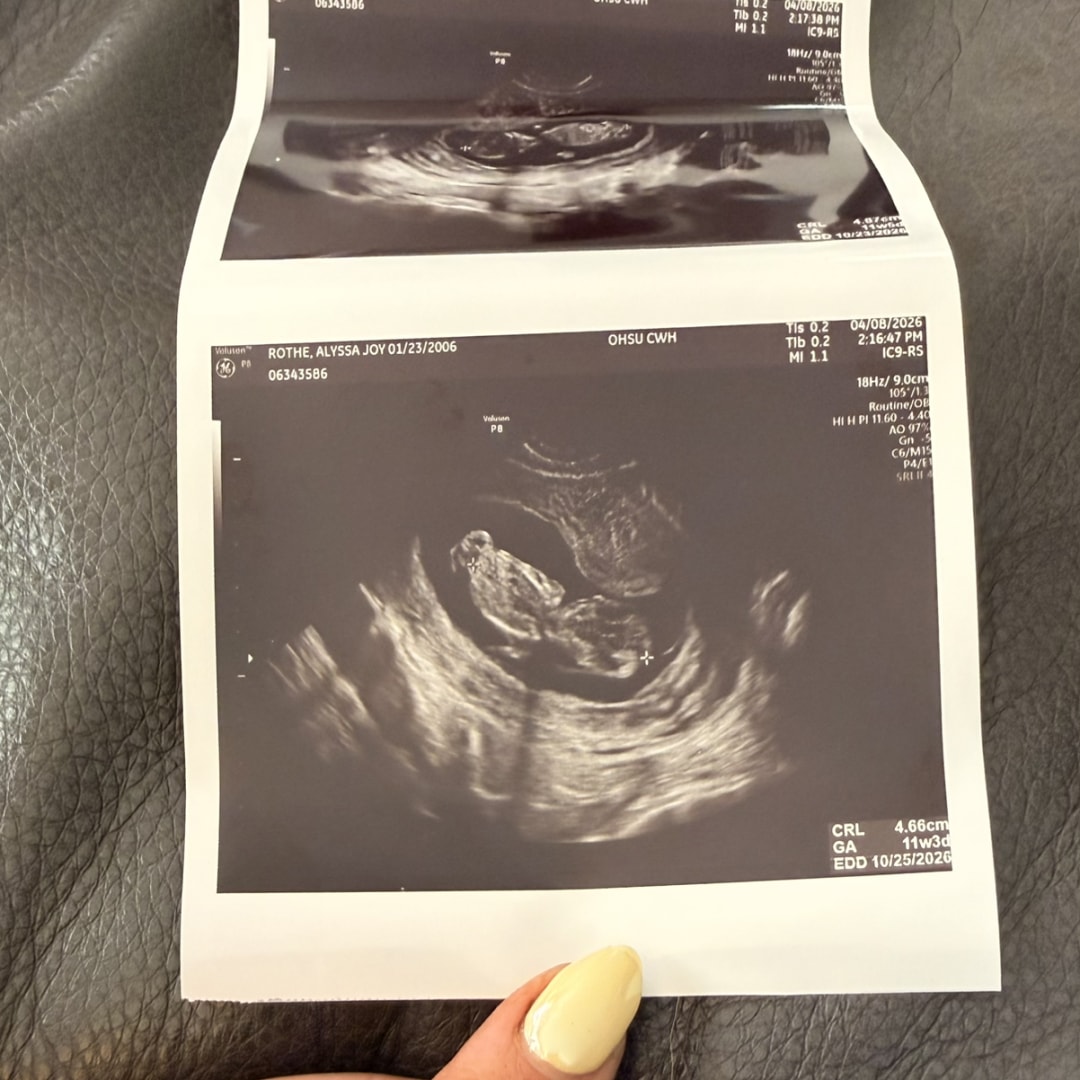 Photo shared by Alyssa for their Babylist baby registry.