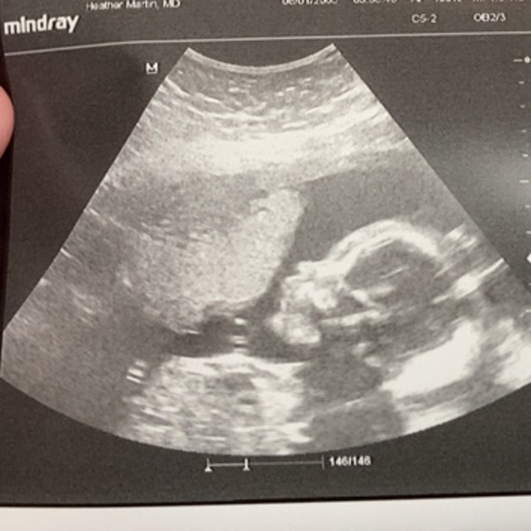 Photo shared by Karleigh for their Babylist baby registry.