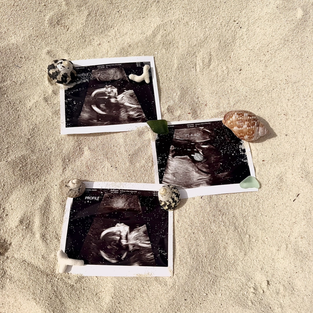 Photo shared by Ella for their Babylist baby registry.