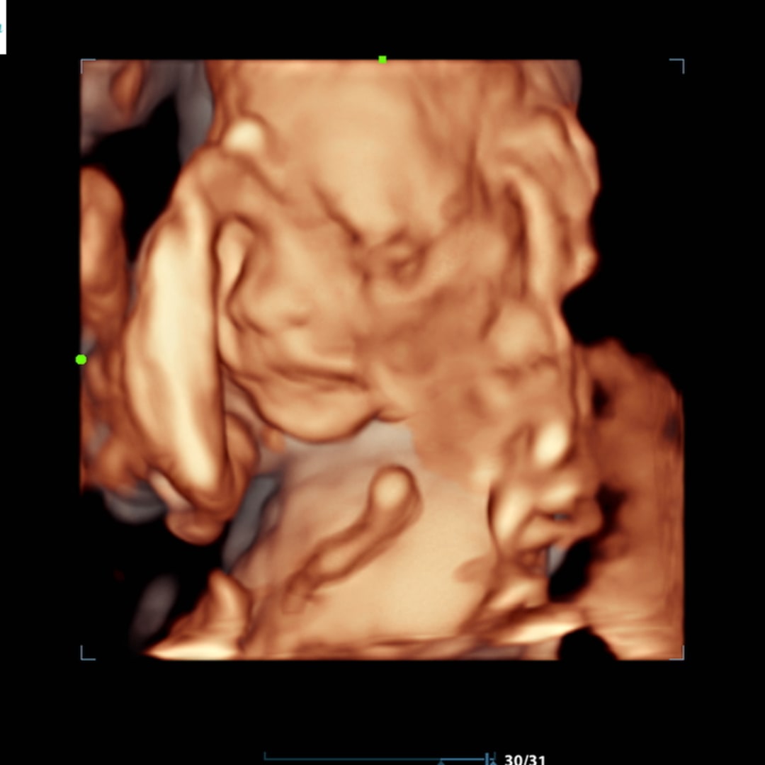 Photo shared by Jacqueline for their Babylist baby registry.