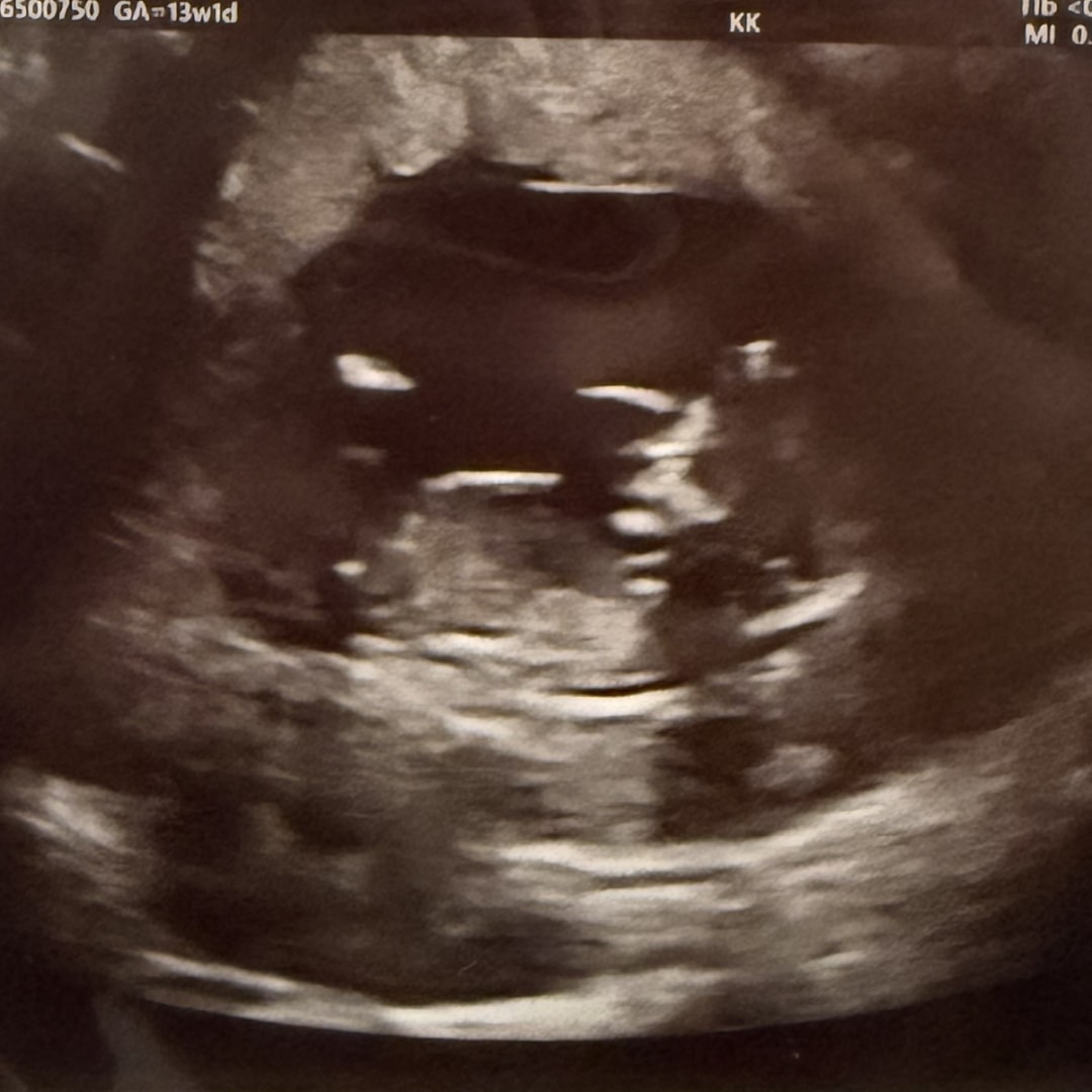 Photo shared by Christinah for their Babylist baby registry.