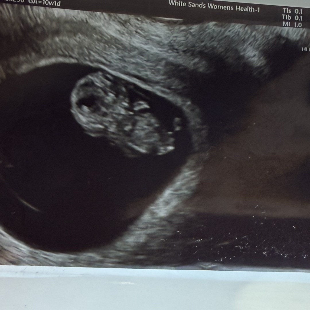 Photo shared by Isadora for their Babylist baby registry.