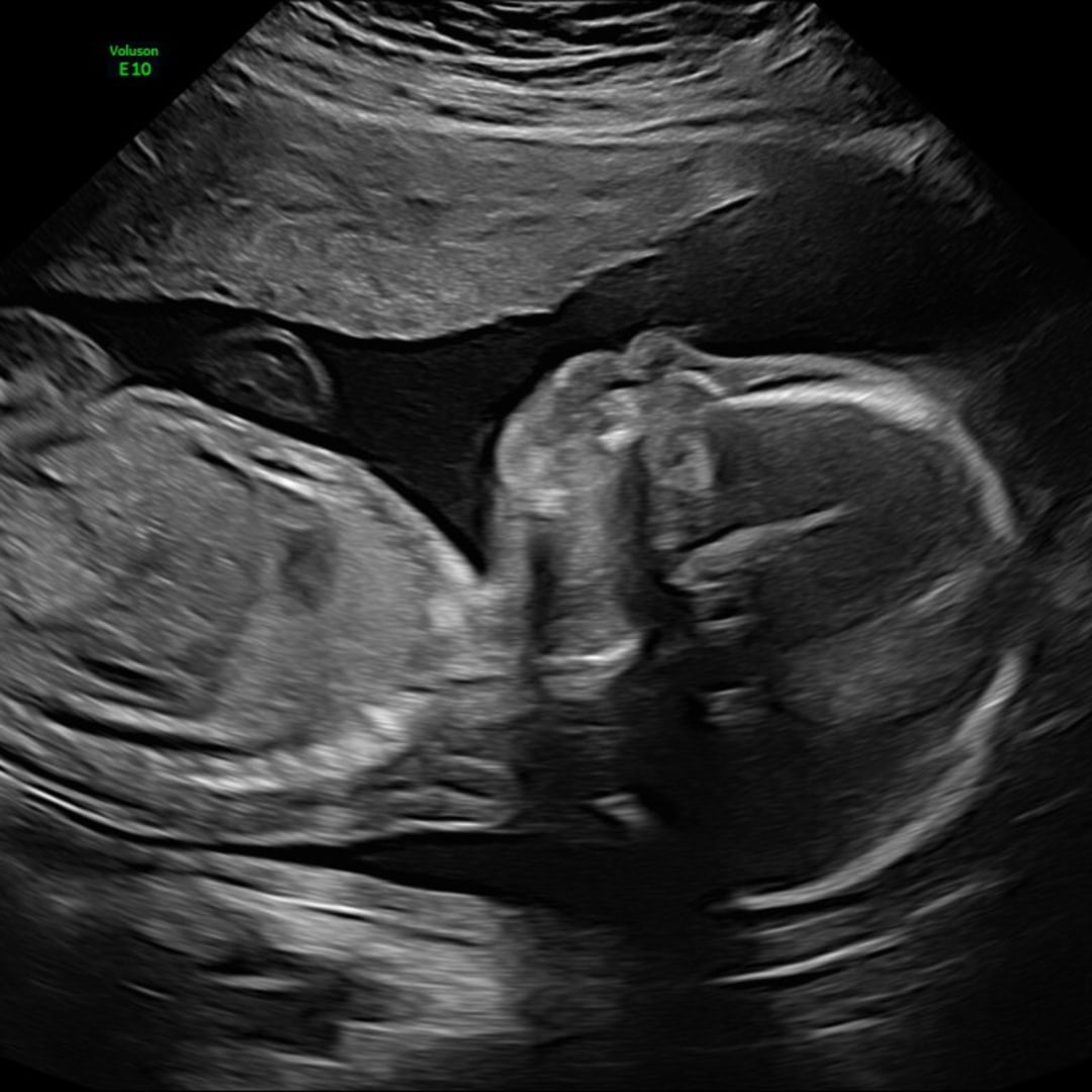 Photo shared by Lena for their Babylist baby registry.