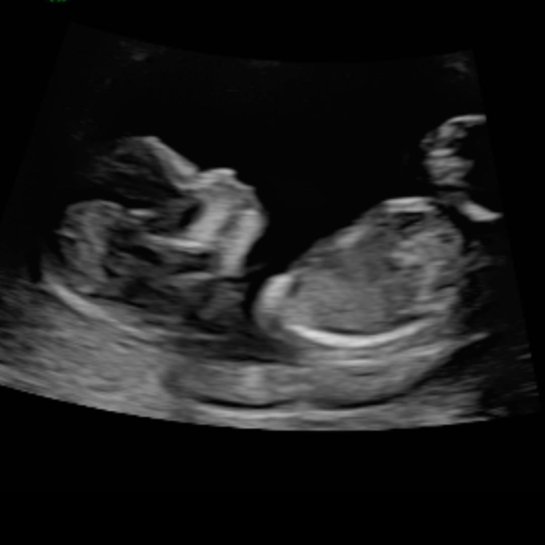 Photo shared by Kristina for their Babylist baby registry.