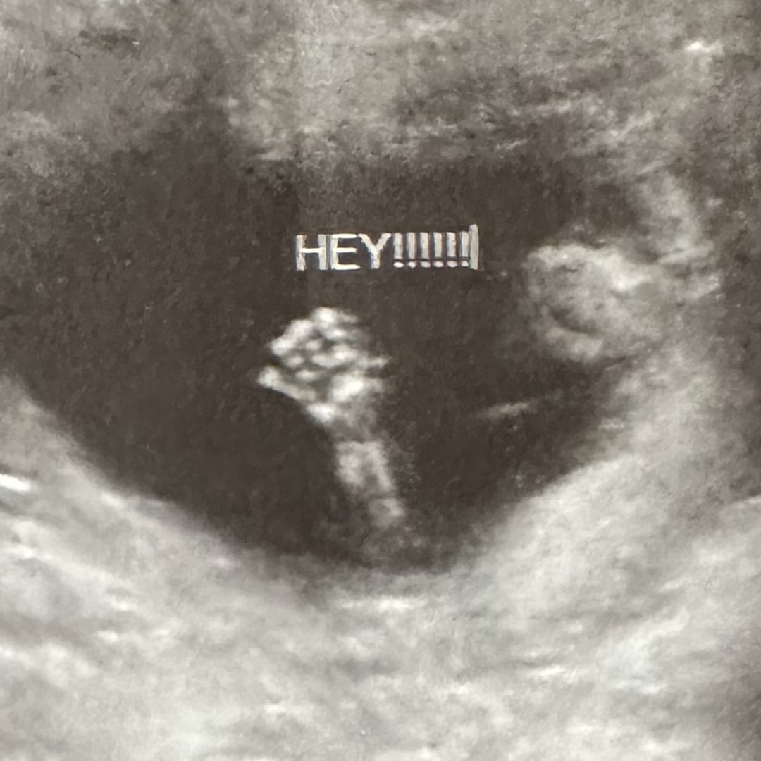 Photo shared by Dru for their Babylist baby registry.