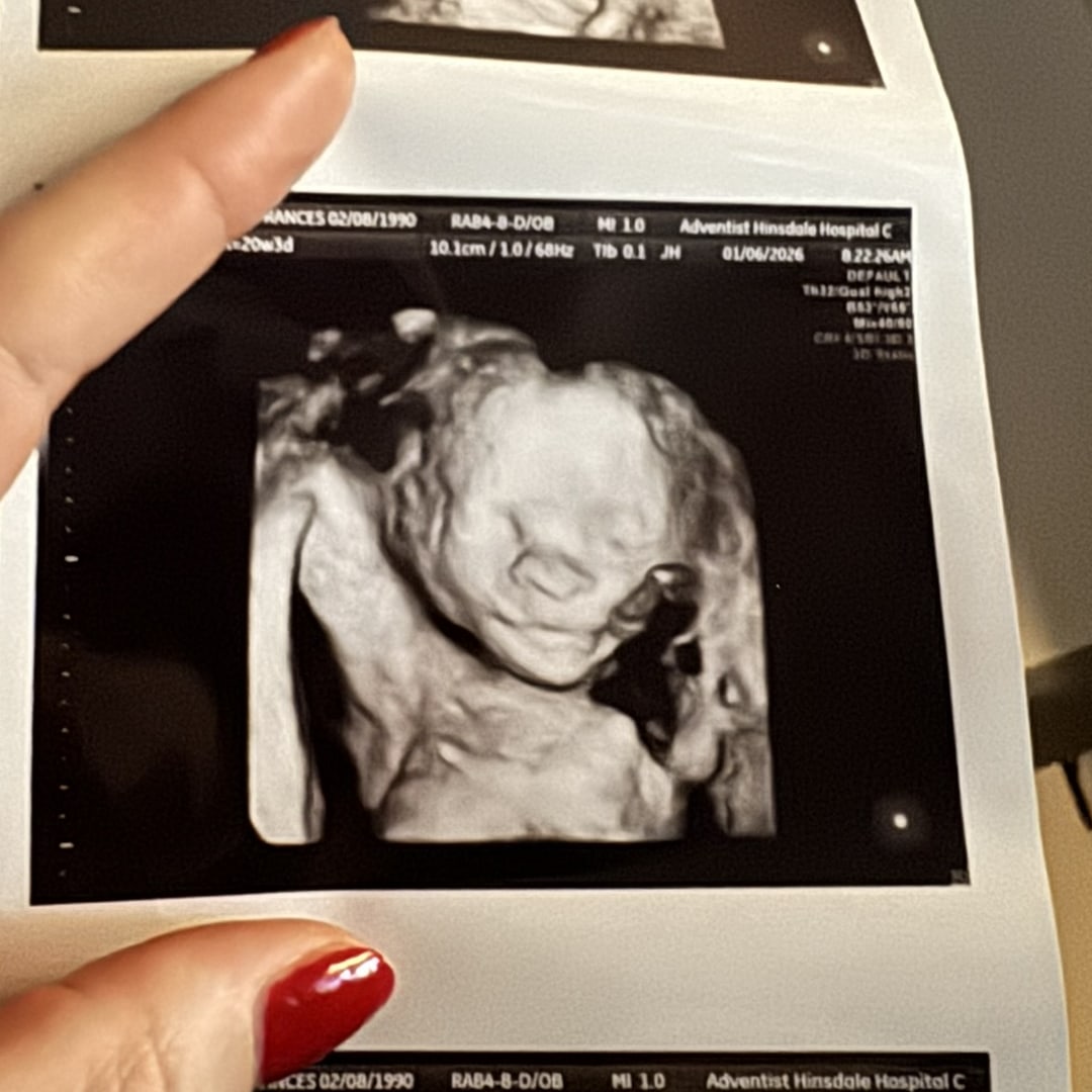 Photo shared by Brenna for their Babylist baby registry.