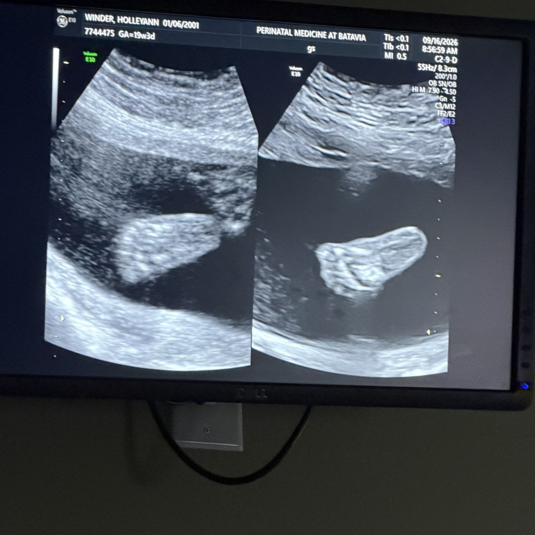 Photo shared by Holleyann for their Babylist baby registry.