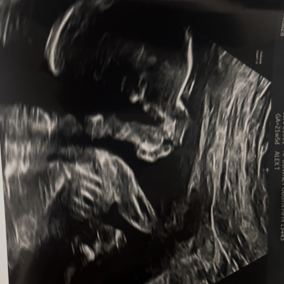 Photo shared by Brenda for their Babylist baby registry.