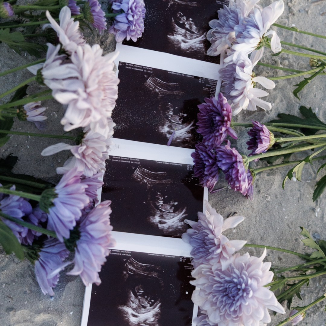 Photo shared by Hannah for their Babylist baby registry.